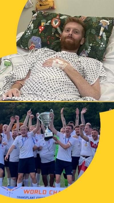 Transplant world cup